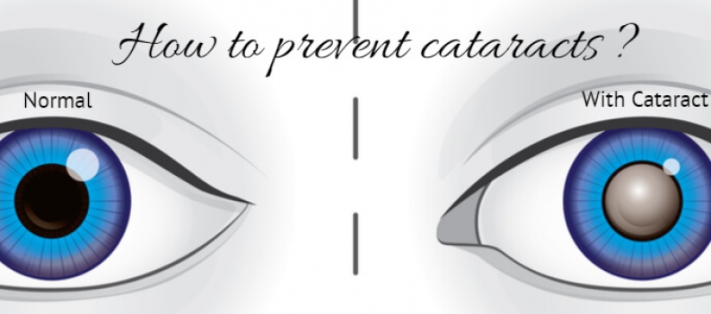 Protect Your Vision & Prevent Cataracts With Dietary & Lifestyle Changes